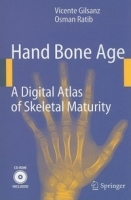 Hand Bone Age: A Digital Atlas of Skeletal Maturity артикул 1150c.